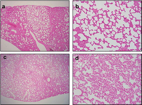 Figure 1. Lung histology of rats exposed to 0.85 LD50. Both male and female rats were exposed to a 0.85 LD50 dose of 1080. Rats were observed for 24 h in a whole-body plethsymograph chamber and euthanized at 24 h. Tissues were collected for histological analysis by H&E staining. Hemorrhage was observed in the lungs of 7 of the 8 exposed animals examined. There was no observed difference between the male and female tissues. (a) Control left lung lobe 40x, (b) Control left lung lobe 200x, (c) Exposed left lung lobe 40x, (d) Exposed left lung lobe 200x.