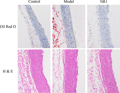 Figure 2 Impact of notoginsenoside R1 administration on aortic histopathological features in rats (200×). The abdominal aorta was extracted promptly upon rat euthanasia. We conducted Oil Red O staining and H&E staining to visualize plaque size and lipid content.