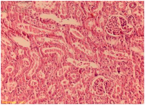 Figure 3. Decreased tubular necrosis, with desquamations of tubular epithelium (sitagliptin-treated group). H&E × 200.