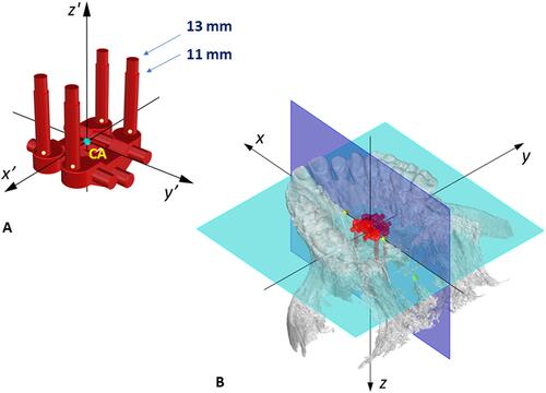 Figure 5 Setting of MSE in the maxilla in the initial default position. (A) Virtual model of MSE appliance with 4 micro-implants; the center of the appliance (CA), the light blue dot, is computed as the midpoint of the center of 4 micro-implant slots (yellow dots) and is set as the origin of MSE coordinate system. (B) MSE located in the initial default position in the maxilla, in which the CA point is coincident with the center of maxilla (CM) point, and the MSE x’, y,’ z’ coordinate system is aligned with the maxilla x, y, z system.