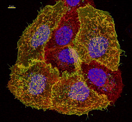 Figure S1.  Co-localization of TRPV4-GFP and a plasma membrane marker. HaCaT cells were transfected with TRPV4-GFP (green) and 48 h after transfection plasma membrane was counterstained using plasma membrane marker (see Materials and methods) (red). Nuclei were stained with Hoechst (blue). The four TRPV4-GFP transfected cells display strong co-localization with plasma membrane marker (yellow), demonstrating clearly TRPV4 localization in plasma membrane. Bar = 5 µm.