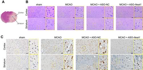 Figure 6 Neat1 knockdown alleviated the ischemic brain tissue damage and suppressed microglia activation after MCAO. (A) Representative images of histological staining of the cortex and striatum from mice after MCAO. Coronal sections were stained with H&E (B) and immunohistochemistry of anti-IBA1 (C). Scale bar, 20 μm. The yellow box shows the enlarged area.