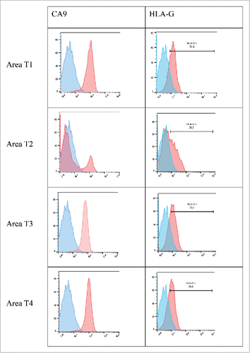 Figure 4. Representative histograms obtained by flow cytometry analysis for CA9 and HLA-G cell-surface expression on tumor cells from 4 different tumor areas in patient #2 are shown. Tumor cells were obtained after mechanic disruption followed by enzymatic digestion of 4 different areas from the surgically-resected tumor (T1, T2, T3, T4). Cells were then cultured for 3 d and then stained with antibody either directed against CD3, CD45, HLA-G or CA9 marker. Tumor cells were considered to be large CD45-negative and CD3-negative cells (data not shown). Percentage of the HLA-G-positive population in CD3− CD45− gated cells is indicated. Blue and red histograms correspond to staining with isotype control and marker, respectively.