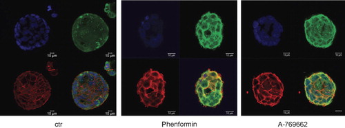 Figure 5.  Cell surface SGLT1 protein abundance in Caco2 cells was similarly upregulated by phenformin and A-769662. Confocal microscopy of Caco2 cells incubated for 6 h in medium without (left panel) or with (middle panel) AMPK activator phenformin (1 mM) or with (left panel) AMPK activator A-769662 (10 μM). The Caco2 cells were subjected to immunofluorescent staining using FITC-conjugated anti-SGLT1 (green) and Cy5-conjugated anti-alpha tubulin antibody (red) and DRAQ-5 dye (blue) for nuclear staining. (This figure is reproduced in colour in Molecular Membrane Biology online.)