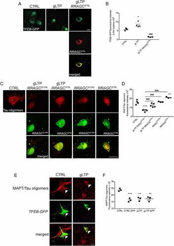 Figure 2. TFEB trafficking to the nucleus is required for activity-dependent reduction of pathological MAPT/Tau in Tg neurons. (A) gLTP induced a significant 44 ± 13% increase of TFEB-GFP in the nucleus of transfected Tg neurons (central panel, green) compared to CTRL (left panel, green). Tg neurons were co-transfected with TFEB-GFP together with a constitutively active mutant RRAGCS75L (right panels, red and merged). Upon gLTP, entrance of TFEB into the nucleus of RRAGCS75L positive neurons was abolished (right panel, green), as quantified in (B) (n = 3–4; one-way ANOVA test, p = 0.0002, followed by Tukey’s multiple comparison post-hoc test: CTRL vs gLTP *p < 0.05, gLTP vs gLTP+RRAGCS75L ###p < 0.001). (C, D). gLTP induced a 59 ± 6% reduction of MAPT/Tau oligomers in RRAGCQ120L compared to CTRL Tg neurons. Prevention of TFEB entrance in the nucleus by transfection with RRAGCS75L abolished activity-dependent clearance of MAPT/Tau oligomers as quantified by confocal immunofluorescence in D (n = 3–5; one-way ANOVA, p = 0.0008 followed by Tukey’s multiple comparison test: CTRL vs gLTP RRAGCQ120L ***p < 0.0001, CTRL vs RRAGCS75L **p < 0.01, gLTP+RRAGCQ120L vs gLTP+RRAGCS75L ###p < 0.001, gLTP+RRAGCQ120L vs RRAGCQ120L ###p < 0.001, gLTP+RRAGCQ120L vs RRAGCS75L ###p < 0.001). (E, F) Transfection with TFEB-GFP reduces levels of MAPT/Tau oligomers (−31 ± 3%) in Tg neurons (CTRL-GFP, left panels, white arrowheads) compared to CTRL. gLTP stimulation reduces MAPT/Tau oligomers (−28 ± 5%) both in Tg neurons transfected with TFEB-GFP (gLTP-GFP, right panels, white arrowhead) and untransfected Tg neurons (−28 ± 4%, gLTP; n = 3; one-way ANOVA, p = 0.0007 followed by Tukey’s multiple comparison test: CTRL vs CTRL-GFP ***p < 0.001, CTRL vs gLTP **p < 0.01, CTRL vs gLTP-GFP **p < 0.01). Scale bars: 10 μm.