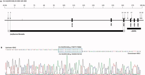 Figure 2. (A) Schematic representation of part of 16p13.3 showing a 190 kb region containing the α-globin gene cluster and flanking regions. The solid boxes denote the α-globin like genes and the regulatory region (HS-40). Black bars show the two deletions, –(NOR) and (αα)Aurora Borealis. The open ends indicate the region where the breakpoint is located. Black arrows and numbers indicate the location of the probes. (B) Characterization of breakpoints by gap-PCR and direct sequencing of –(NOR) showed that the deletion starts upstream of HBA2 at position 170677/170694 and ends at position 184083/184100, downstream of HBQ1. The blue box is the 18 nt homologous sequence where the homologous recombination event occurs.