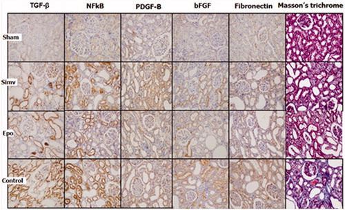 Figure 1. Representative photomicrographs (×40 magnifications) of histochemical staining for Masson’s trichrome demonstrating collagen accumulation in the obstructed rat kidneys. Immunostaining for TGF-β, NFκB, PDGF-B, bFGF and fibronectin are seen in tubular cytoplasms, in addition NFκB staining seen in tubular nuclei and fibronectin staining also seen in interstitium. All staining is the densest in group control and faint in group sham.