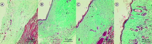 Figure 7. Effect of human umbilical cord mesenchymal stem cells combined with small porcine intestinal submucosa on wound collagen fibers (Masson staining, ×200).(A) Blank control group. (B) Small porcine intestinal submucosa group. (C) Human umbilical cord mesenchymal stem cell group. (D) Human umbilical cord mesenchymal stem cells combined with small porcine intestinal submucosa group.