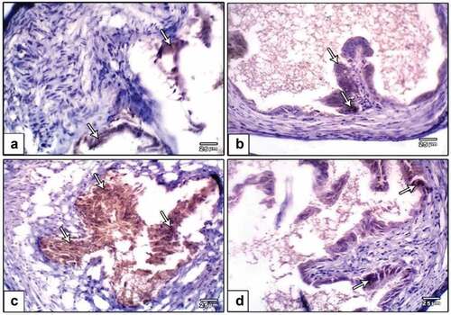 Figure 7. Photomicrographs of formalin-fixed oviduct immunohistochemical stain with Caspase-3, (a) negative control, (b) PVP-capped AuNRs positive control, (c) DMBA carcinogenesis, D. DMBA carcinogenesis treated with PVP-capped AuNRs. Note increased immunostaining of Caspase-3 in DMBA carcinogenesis and improved in PVP-capped AuNRs-treated studied group. The arrow heads show the caspase-3 immunoreactivity. The magnification power used 400 × .
