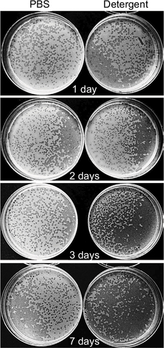 Figure 4 Phage stability in PCHS detergent. Phage stocks were suspended in PBS or in PCHS detergent diluted in water as indicated by the manufacturer, and kept at room temperature in closed plastic tubes for 1, 2, 3, or 7 days. After the indicated times, aliquots were collected and titrated by PFU counting on the corresponding ATCC bacterial target. Samples were performed in duplicate. Pictures refer to anti-E. coli phages. Superimposable results were obtained with the phages directed against S. aureus and P. aeruginosa.