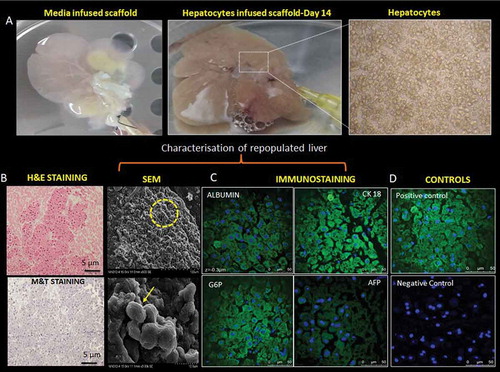 Figure 3. Re-population and characterization of rat liver scaffold. (a) The well-preserved liver scaffold was initially infused with the hepatocyte culture medium. Freshly isolated primary rat hepatocytes were infused into the scaffold through the PV of the decellularized liver. The decellularized liver was fully populated with hepatocytes and continuously perfused with the culture medium for the proliferation and functioning of the engrafted cells. (b) The H&E and MT staining of the reseeded liver graft showed uniform distribution of the hepatocytes throughout the liver section. The hepatocytes were repopulated around the vessels and the surrounding parenchymal spaces throughout ECM as evident from SEM analysis. The arrow indicating the group of hepatocytes in the scaffold. (c)The liver-specific proteins like albumin, CK 18, G6P, and AFP expression were observed (green fluorescence) on the cell surfaces and the nucleus was stained with DAPI (blue) of repopulated liver section. (d) Staining of the native rat liver as positive control and staining of the nucleus with DAPI as negative control without primary antibody.