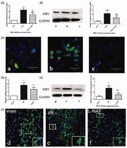 Figure 3. Changes in the expression of RIP2 after HIRI. (A) Relative mRNA levels of RIP2 in BRL cells. Detected by quantitative qRT-PCR (n = 3). (B) Western blot analysis of RIP2 protein expression in BRL cells. (C) Immunofluorescence staining (200X) in BRL cells. (a) Cont, (b) H2O2, (c) H2O2+l-NAT. (D) Relative mRNA levels of RIP2 in rat liver tissues detected using quantitative qRT-PCR (n = 3). (E) Western blot analysis of RIIP2 protein expression in rat liver tissues. (F) Immunofluorescence staining (200×) in rat liver tissues (d) sham, (e) I/R, (f) l-NAT. Data are mean ± SD; **p < 0.01, *p < 0.05 compared with the related Cont group or sham group, ##p < 0.01, #p < 0.05 compared with related H2O2 group or I/R group.