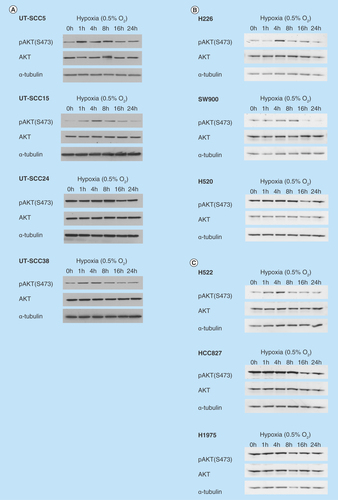 Figure 1.  Induction of phosphorylation of AKT by hypoxia in head and neck squamous cell carcinoma and non-small-cell lung cancer cell lines.Expression of pAKT(S473) and AKT after incubation with hypoxia (0.5% O2) in (A) four head and neck squamous cell carcinoma; (B) three squamous cell carcinoma non-small-cell lung cancer and (C) three adenocarcinoma non-small-cell lung cancer cell lines. α-tubulin was used as loading control.