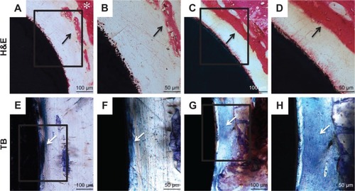 Figure 13 Histological sections of the Ti (A, B, E, F) and ICA-loaded (C, D, G, H) implants.Notes: Bone morphology around Ti and ICA-loaded implants was observed at 2 weeks after implantation by H&E (A–D) and TB (E–H) staining. B, D, F and H depict zoomed areas of black box in A, C, E and G, respectively. Bars indicate 100 µm (A, C, E, G) and 50 µm (B, D, F, H). The black arrow denotes new bone formation; white asterisk indicates native bone; white arrow denotes collagen-rich matrix.Abbreviations: ICA, icariin; TB, toluidine blue; Ti, titanium.