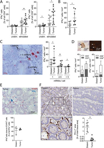 Figure 4. Lymphocyte activity in vitro and in situ.(A) In vitro IFNγ production of CD4+ (left) and CD8+ (right) cells unstimulated and stimulated ex vivo with anti-CD3/CD28 coated beads for 16 h, measured with flow cytometry. (B) IFNγ mRNA expressing cells quantified in situ on tissue sections of distant mucosa and tumors (n = 8). (C) Photograph of a tumor section showing the IFNγ mRNA staining (red). The quantification of cells expressing 1, 2–5 or more than 5 IFNγ mRNA per cell (arrows) is illustrated on the right (n = 8). Magnification: 40x, Scale bar: 50 µm. (D) Samples were stained for IFNγ mRNA using RNAscope and co-stained for either CD3 or CD8 by IHC (the insert shows an example of a CD8+INFγ+ cell). The graphs indicate the densities of IFNγ+ cells in the respective tissue and show additionally how many of them are CD3+ (left, distant n = 5, tumor n = 6) or CD8+ (right, distant n = 4, tumor n = 6). (E) Tumor tissue section stained for FOXP3 mRNA (red) and IFNγ mRNA (blue). Quantification of IFNγ mRNA+ cells in close proximity (max. 3 nuclei in between) to FOXP3+ cells (n = 3). All IFNγ mRNA+ cells are 100%. (F) IHC staining and quantification of PD-L1 in distant mucosa and tumor tissue (n = 9). Magnification: 20x, scale bar: 100 µm. Error bars show mean with SD; * p < 0.05, ** p < 0.01, *** p < 0.001