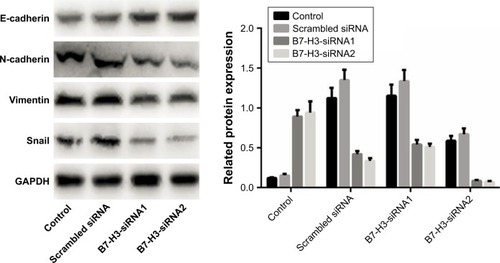 Figure 4 B7-H3 regulates the protein expression levels of E-cadherin, N-cadherin and vimentin.