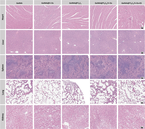 Figure 10 H&E staining sections of important organs (lung, heart, liver, spleen and kidney) in experimental animals, the scale length is 100μm.