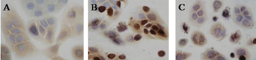 Figure 4.  Nuclear factor kappa B (NF-κB) P65-positive expression in HaCaT cells (SP × 400). (A) NF-κB P65-positive expression in cytoplasm of normal cells, (B) NF-κB P65-positive expression in nuclei of some cells stimulated with tumor necrosis factor alpha (TNF-α)/interferon gamma (IFN-γ) for 0.5 h, and (C) NF-κB p65 expression in cytoplasm of cells stimulated with 0.5 mmol/L naringin for 16 h and TNF-α/IFN-γ for 0.5 h.