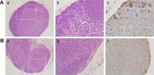 Figure 6 Histological observation (a, b) and immunohistochemical staining (c) of F4/80 in lymph node tissue sections.Notes: (A) Experimental group (35 mg/kg dosage group); (B) control group (saline-treated group). Magnifications: (a) 100×; (b, c) 400×. White ovals indicate F4/80 positive cells. The white panes indicate amplified fields.