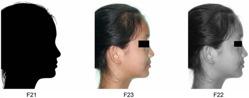 Figure 2 Models of silhouette (F21), black and white photograph (F22), and chromophotograph (F23) of the same girl.