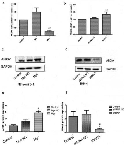 Figure 6. (a)The expression of ANXA1 mRNA in the Nthy-ori 3–1 cell line with overexpression MYC group has a decreased trend, compared with the NC group(P < 0.05). (b)The expression of ANXA1 mRNA in the IHH-4 cell line interference MYC group shows an increasing trend, compared with the NC group (P < 0.05). (c)The expression of ANXA1 protein in the overexpressing MYC group was significantly increased in the Nthy-ori 3–1 cell line(P < 0.05), compared with the control group and NC group. (d)The expression of ANXA1 protein in the interference MYC group showed a downward trend in the IHH-4 cells(P < 0.05), compared with the control group and NC group. (* means treating group compared with Control; # means treating group compared with NC group).