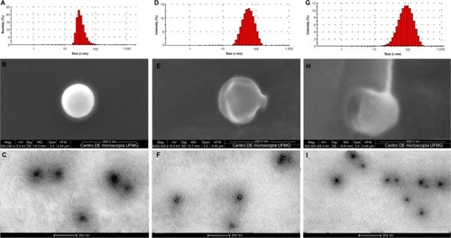 Figure 2 Size, polydispersity index (PI), and morphology of the engineered nanoparticles: (A) particle-size distribution of NQs determined by photon correlation spectroscopy (PCS), (B) scanning electron microscopy (SEM) image of an NQ, (C) transmission electron microscopy (TEM) image of NQs, (D) particle-size distribution of NQCs by PCS, (E) SEM image of an NQC, (F) TEM image of NQCs, (G) particle-size distribution of NQC-AmpB by PCS, (H) SEM image of an NQC-AmpB, and (I) TEM image of NQC-AmpB.Abbreviations: NQ, chitosan nanoparticle; NQC, chitosan-chondroitin sulfate nanoparticle; NQC-AmpB, chitosan-chondroitin sulfate-amphotericin B nanoparticle; TPP, sodium triphosphate.