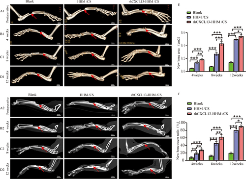 Figure 10 Postoperative CT Analyses of Radial Bone Defects: (A) Immediate postoperative 3D and sagittal CT (A1 and A2). (B) 4-week postoperative 3D and sagittal CT (B1 and B2). (C) 8-week postoperative 3D and sagittal CT (C1 and C2). (D) 12-week postoperative 3D and sagittal CT (D1 and D2). (E) Statistical analysis of new bone area and coverage across groups using 3D and sagittal CT at 4, 8, and 12 weeks postoperative (E and F). Data analyzed by ANOVA and LSD tests, expressed as mean ± SD (*p < 0.05, **p < 0.01, ***p < 0.001, n=3).