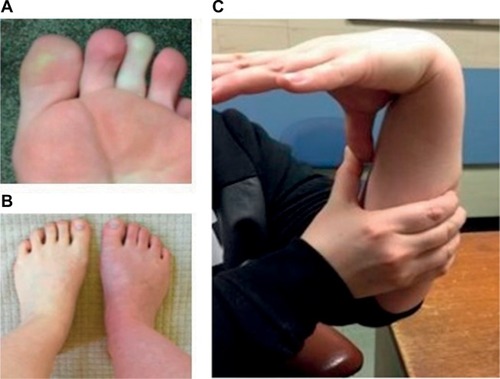 Figure 3 Common clinical signs.