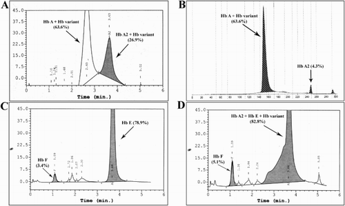 Figure 1. Hb typing by HPLC (A, C, and D) and CE (B). (A) Proband (I-1) showing two overlapping peaks at A- and A2-window. (B) Proband (I-1) showing peaks of Hb A and Hb A2. (C) Proband’s wife (I-2) showing single peak of Hb A2/Hb E. (D) Proband’s son (II-1) showing overlapping peak of variant Hb, Hb E, and Hb A2 and peak of Hb F.