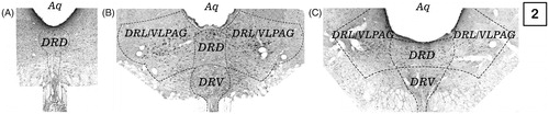 Figure 2. Dorsal raphe subdivisions. (A), at −6.96 mm from bregma; (B), At −7.68 mm from bregma and (C), at −8.04 mm from bregma. Aq, aqueduct; DRD, dorsal raphe dorsal; DRL, dorsal raphe lateral; DRV, dorsal raphe ventral.