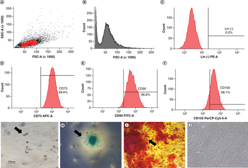 Figure 1. Characteristics of hWJ-MSC.Analysis of specific cell surface marker: (A) Plotting cells; (B) Negative isotype control. (C) Negative marker: CD45, CD34, CD11b, CD19, HLA-DR. Positive marker: (D) CD73; (E) CD 90; (F) CD 105. Multipotency analysis: (G) Adipocyte differentiation using Oil Red O, (H) chondrogenesis differentiation with Alcian blue staining and (I) osteocyte differentiation with Alizarin red staining. (J) hWJ-MSC morphology at 90% confluency. Black arrow shows positive result of differentiation.hWJ-MSC: Human Wharton jelly’s mesenchymal stem cells.Scale bar = 100 μm.