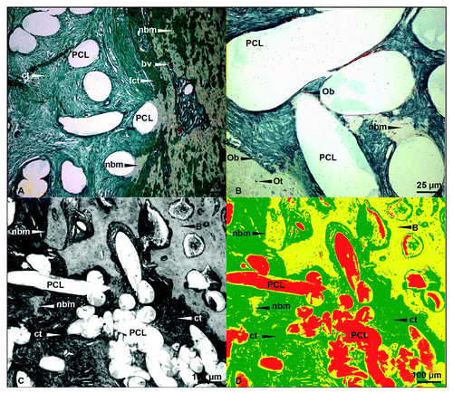 Figure 5. Modified Masson-Goldner trichrome staining: detailed investigation. (A) Modified Masson-Goldner trichrome, (B) detailed description, (C) original image for histological quantification using false coloring, (D) false coloring of image C using Olympus software “cellD”. Connective tissue in green (45%), bone in yellow (35%) and PCL fiber in red (20%); (original magnification: [A, C, and D] 100x; [B] 400x). Ob, osteoblast; Ot, osteocyte; bv, blood vessel; nmb, new bone matrix; fct, firm connective tissue; ct, connective tissue.