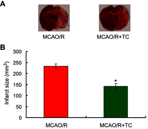 Figure 1 Comparison of the infarct sizes between MCAO/R group and MCAO/R+TC group. (A) The infarct images for both MCAO/R group and MCAO/R+TC group. (B) Statistical analysis for the infarct size in MCAO/R group and MCAO/R+TC group. *p<0.05 vs MCAO/R group.