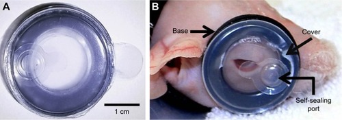 Figure 1 An OWC measuring 3 cm in diameter has been developed for ocular use with a flexible base that attaches to the perimeter of the eye (A). The device has a transparent cover and a self-sealing port that allows for the delivery of therapeutics (A). The OWC has been specifically designed for use in our guinea pig model (B) and provides a watertight seal that allows for the creation of a controlled microenvironment over the eye. The base, cover, and self-sealing port are labeled accordingly as indicated by arrows (B).
