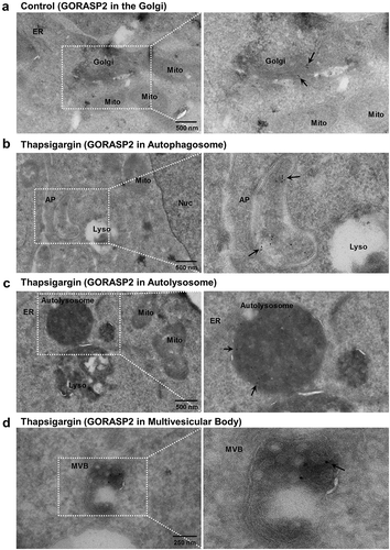 Figure 6. Immunoelectron microscopy of GORASP2/GRASP55. Transmission electron microscopy was performed in HEK293 cells after immunogold labeling of GORASP2, as described in the Materials and Methods. Fields enclosed by boxes are shown at higher magnification to the right. (a) In control cells, GORASP2 was principally localized in the Golgi complex. Upon thapsigargin treatment (1 µM, 6 h), GORASP2 was detected in (b) crescent-shaped autophagosomes (AP), (c) autolysosomes, and (d) multivesicular bodies (MVB). Arrows indicate immunogold-labeled GORASP2. Mito, mitochondria; Nuc, nucleus; Lyso, lysosome.