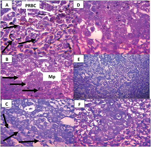 Figure 4. Photomicrograph of cross histological section of the placenta from mice treated with different concentrations of C. citratus; (a-c) Infected mice treated with 100, 200 and 300 mg/kg body weight respectively. (d-f) Non-infected mice treated with 100, 200 and 300 mg/kg body weight, respectively. (a-c) few trophoblastic cells that appear pyknotic in the infected-treated group (Long arrow). (d-f) No visible lesions in non-infected groups. Parasitized red blood cells (PRBC). H and E × 400