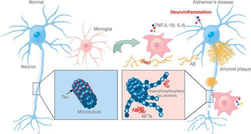 Figure 1 The mechanisms of neuroinflammation mediated by microglia activation in AD.