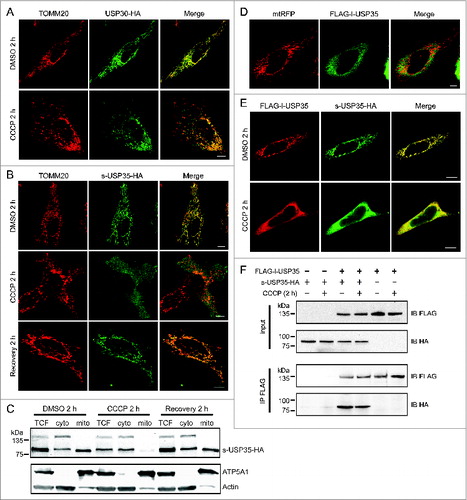 Figure 2. Detailed analysis of USP30 and USP35 localization. (A) HeLa cells transfected with USP30-HA for 16 h were treated with either CCCP or DMSO for 2 h. These cells were fixed and immunostained with anti-TOMM20 (red) and anti-HA antibodies (green). (B) s-USP35-HA was expressed in HeLa cells for 16 h. Cells were then treated with DMSO or CCCP for 2 h. In order to recover mitochondrial potential, cells treated with CCCP for 2 h were washed once with 1× DPBS and were incubated in regular growth media for 2 h. Cells were then fixed and immunostained with anti-HA antibody. (C) HeLa cells expressing s-USP35 were treated with DMSO, CCCP, or allowed for potential recovery for 2 h. Mitochondrial fractions (mito) were isolated from the cytosolic fraction (cyto). Total cell lysates (TCF), cyto, and mito fractions were examined by SDS-PAGE and immunoblotting. (D) FLAG-l-USP35 was cotransfected with mitochondrial-targeting RFP (mtRFP) for 16 h in HeLa cells. Cells were fixed and immunostained with anti-FLAG antibody. (E) HeLa cells were cotransfected with FLAG-l-USP35 and s-USP35-HA and then treated with CCCP or DMSO for 2 h as indicated. Before fixation, cells were treated with digitonin to remove the cytosolic signal of l-USP35. Fixed cells were immunostained with anti-FLAG and anti-HA antibodies. (F) FLAG-l-USP35 and s-USP35-HA were transfected individually or cotransfected into HeLa cells for 24 h. Cells were then treated with CCCP or DMSO for 2 h. Cleared cell lysates were immunoprecipitated for FLAG tagged proteins using anti-FLAG antibody and protein A-agarose beads. Protein contents were analyzed on SDS-PAGE and immunoblot with anti-FLAG and anti-HA antibodies. Scale bar: 10 µm.