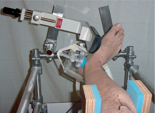 Figure 2. The RSA external rotation stress examination