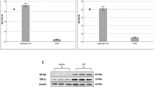 Figure 1. (a) western blot analysis of TGF-β1, (b) western blot analysis of NF-kB, (c) western blot analysis of TGF-β1 and NF-kB normalized to β-actin.