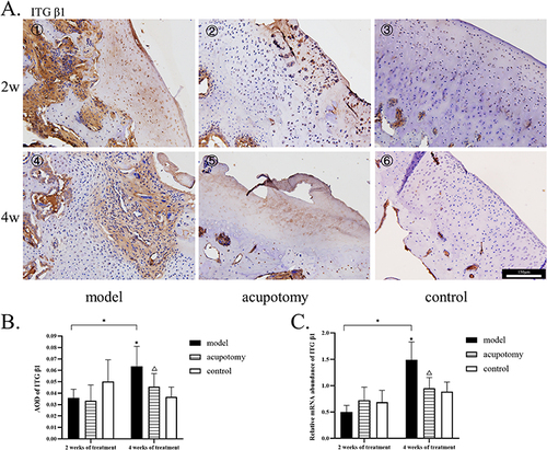 Figure 7 (A) 1–6: The immunohistochemistry staining of ITG-β1; ITG-β1 staining of the model group had more yellow staining. All pictures use the scale in the image ⑥. (B) Quantitative analysis of the IOD of ITG-β1. (C) The mRNA levels of ITG-β1. Compared with the control group during the same time period, *P is < 0.05; Compared with the model group during the same time period, ΔP is < 0.05.