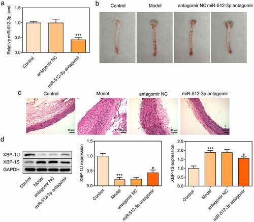 Figure 8. Downregulation of miR-512-3p alleviated atherosclerotic lesions in AS model mice. ApoE-/- mice were nourished with a high-fat diet to establish an in vivo model of AS. miR-512-3p antagomir or antagomir NC were injected into ApoE-/- mice through the tail vein. (a) RT-qPCR for determination of miR-512-3p level. *** p < 0.001 versus antagomir NC. (b) Photos of aortic tissues and atherosclerotic plaques. (c) H&E staining for evaluating atherosclerotic lesions of aortic tissues. (d) Western blot assay for determination of XBP-1 U and XBP-1S protein levels. *** p < 0.001 versus Control, # p < 0.05 versus antagomir NC