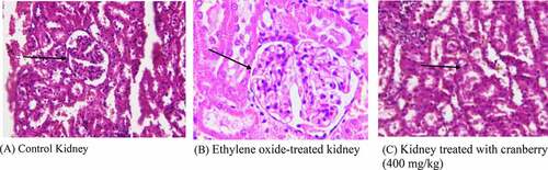 Figure 3. Histopathological examination of the kidneys of rats before and after treatment with cranberry (scale bar 35 microns with 40x magnification). Although the architecture of the kidney tissue remained normal, EtO dilation of renal tubules could be observed