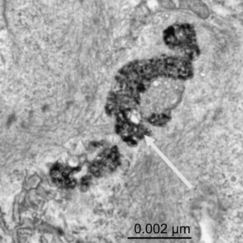 Figure 2. High magnification electron microscopy image (X10000) shows a conglomeration of SPIOs within membrane‐bound organelles (arrow). (View this art in color at www.dekker.com.)