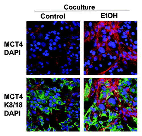 Figure 4. Ethanol increases the expression of MCT4 in cancer-associated fibroblasts. MCF7 cells were plated in co-culture with fibroblasts, and cells were treated with 100 mM EtOH for 72 h. Cells were fixed and immunostained with antibodies against MCT4 (red, upper panels) and K8/18 (green, lower panels). Nuclei were counterstained with DAPI (blue). Note that treatment with EtOH greatly increases the expression of MCT4 in cancer-associated fibroblasts. Original magnification, 40x.