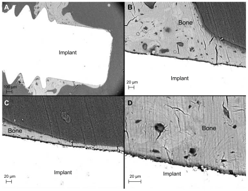 Figure 11 Back-scattered electron micrographs of the 60 nm patterned implant after 28 days. (A) Low magnification image showing the implant and bone tissue. (B) Higher magnification of direct bone contact observed in the endosteal compartment (Part A). Osteocyte lacunae and canaliculi frequently observed close to the implant surface in the medullary compartment. (C) Mineralized bone in direct contact with the implant surface (Part B). (D) Osteocyte lacunae detected in the vicinity of the implant surface.