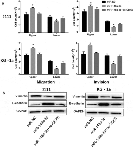 Figure 6. Effect of CDK6 overexpression on the invasion and migration in AML cells which transfected with miR-148a-3p mimics. A: CDK6 overexpression plasmid or control plasmid was co-transfected with miR-148a-3p mimics or miR-NC for 48 h, and Transwell was used to measure the cell invasion and cell migration; B: Invasion and migration related protein expression was measured by Western blot. Compared with miR-NC, *P < 0.05