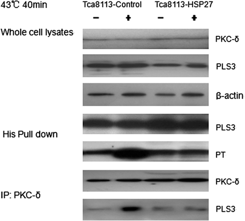 Figure 13. Hsp27 suppresses the interaction between PKC-δ and PLS3. The Tca8113 cells were co-transfected with the control or Hsp27 plasmids and the PLS3 plasmid for 24 h respectively. The co-transfected cells were heated at 43°C for 40 min and then cultured at 37°C for 4 h, whole cell lysates were incubated with Ni beads to pull down His-tagged PLS3, and analysed with the antibodies against phosphothreonine and PLS3 by western blotting. PKC-δ was immunoprecipitated from whole cell lysates and analysed with antibodies against PKC-δ and PLS3 by western blotting. Western blotting assay showed Hsp27 blocked the PLS3/PKC-δ interaction and decreased the phosphorylation level of PLS3.
