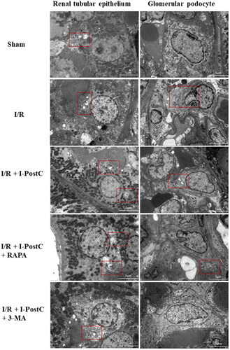 Figure 6. Ultrastructural changes in renal tubular epithelial cells and glomerular podocytes from rat kidneys as observed using a fluoroscopic electron microscope. Scale bar = 5 μm.