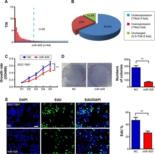 Figure 1 miR-429 is downregulated in GC and reduces GC cancer cell growth rate in vitro.